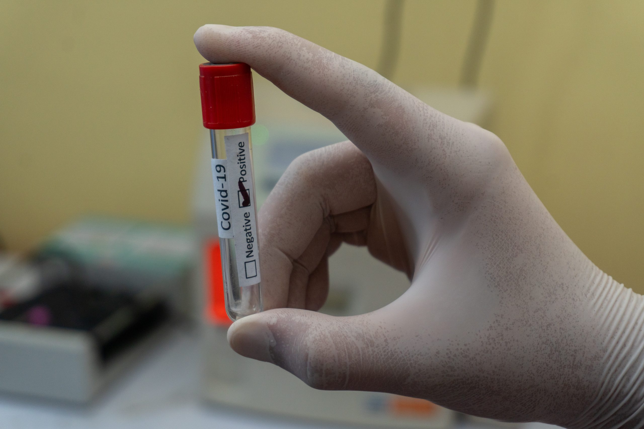 An image of a gloved hand holding a small vial that says "covid" and positive/negative. The positive is checked.