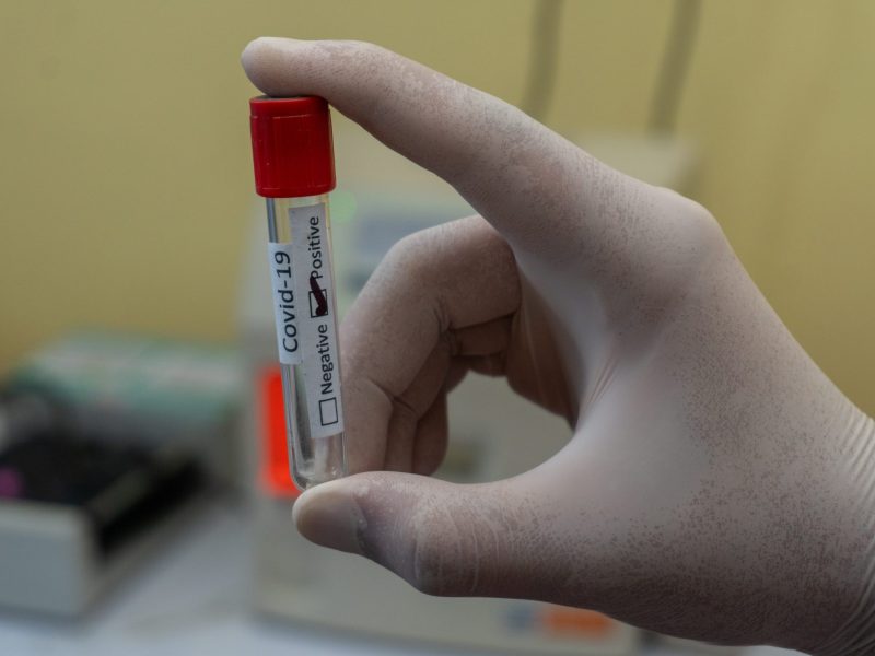 An image of a gloved hand holding a small vial that says "covid" and positive/negative. The positive is checked.